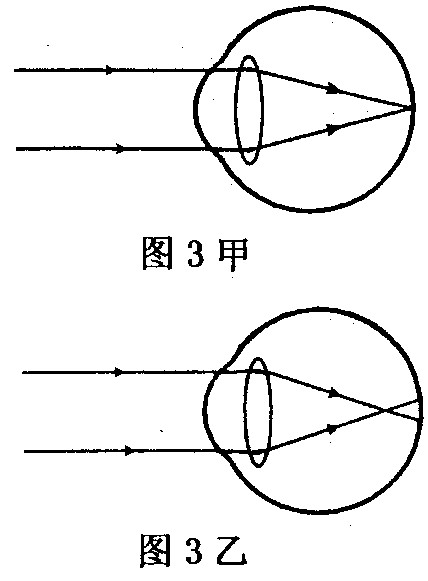 如图甲是正常眼睛对光的作用情况,则图乙:a.是近视眼